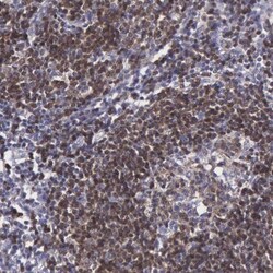 MICAL3 Antibody, Novus Biologicals:Antibodies:Primary Antibodies